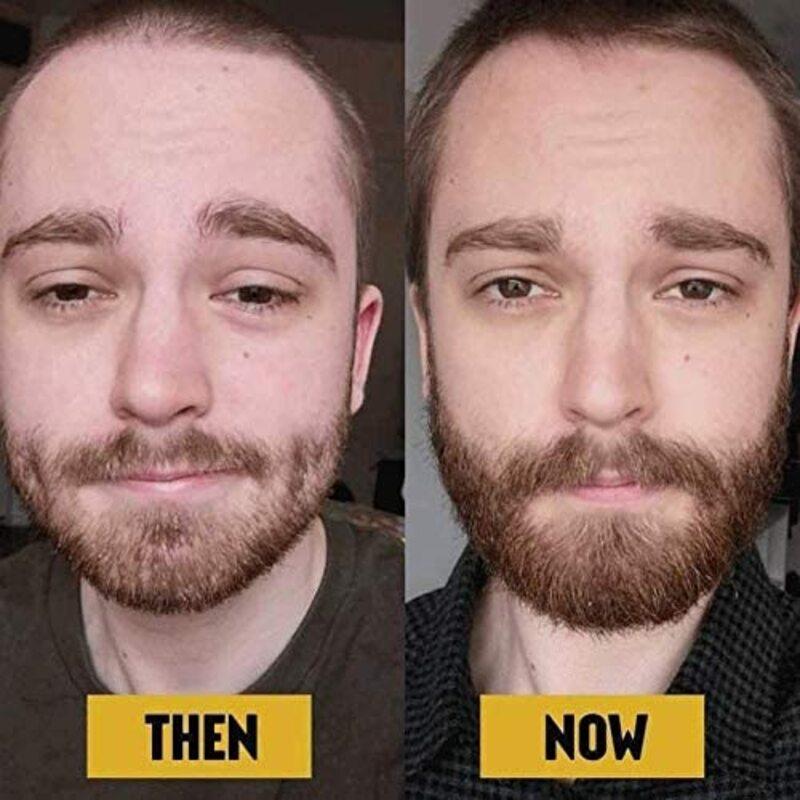 the-beard-club-before-and-after